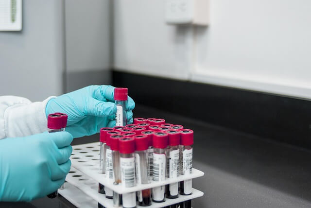 Your Labs Can Be ‘Normal’ — And You Can Still Feel Awful. Here’s Why.